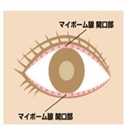 ドライアイ目の画像.jpg