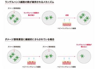 ランゲルハンス細胞の画像.jpg