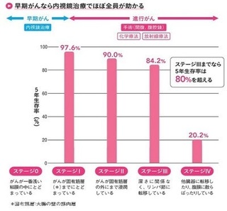 大腸がんの5年生存率のグラフ.jpg