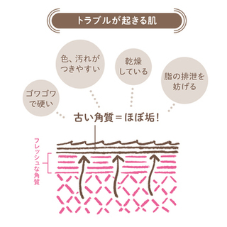 洗顔法1−トラブルが起きる肌.jpg